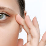 Best remedies for dark circles under eye in tamil